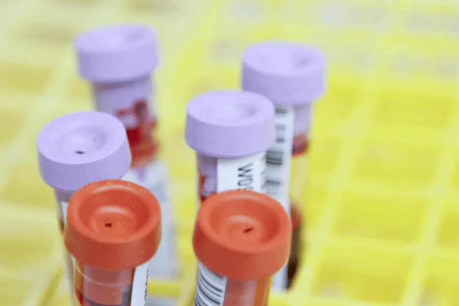 Measures to combat infectious disease in tsarist Russia - IELTS Reading with Practice Test, Answers And Explanation